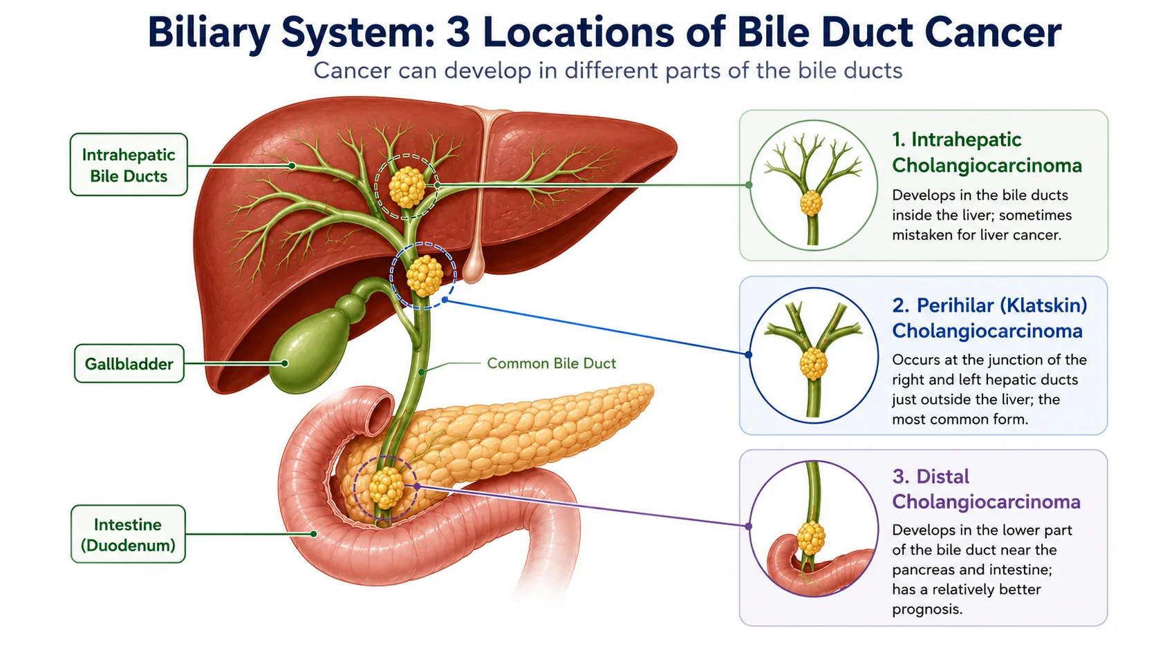 bile duct cancer treatment in delhi ncr