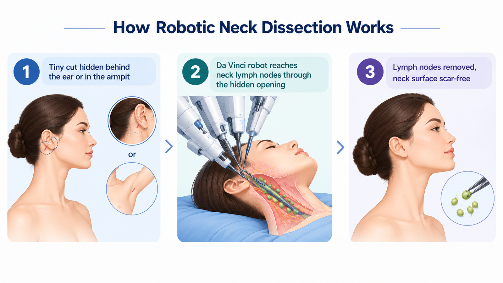 Robotic Cancer Surgery - Neck Dissection