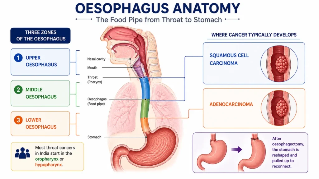 esophageal cancer treatment in delhi ncr