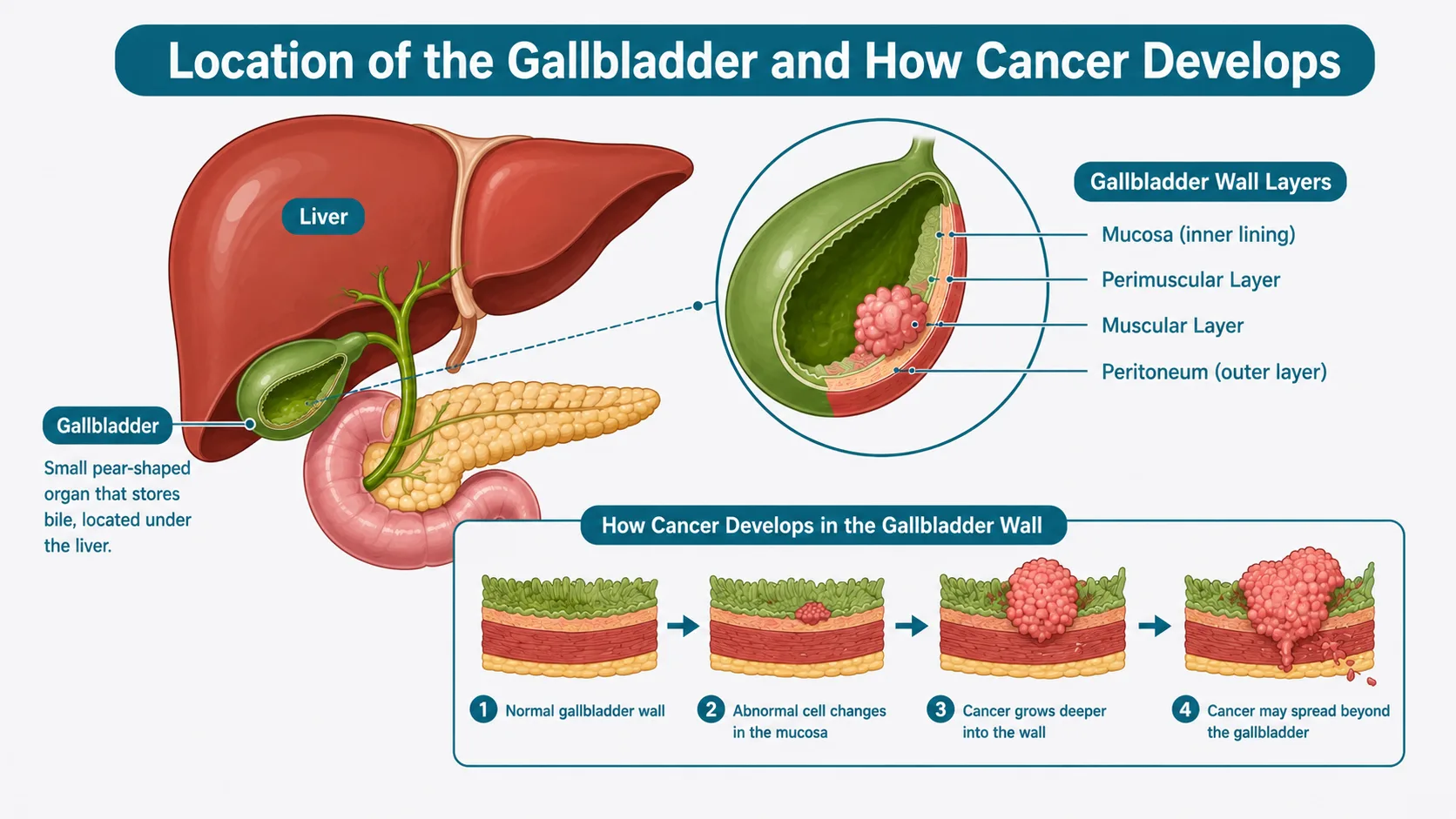 best doctor for gallbladder cancer in Delhi NCR